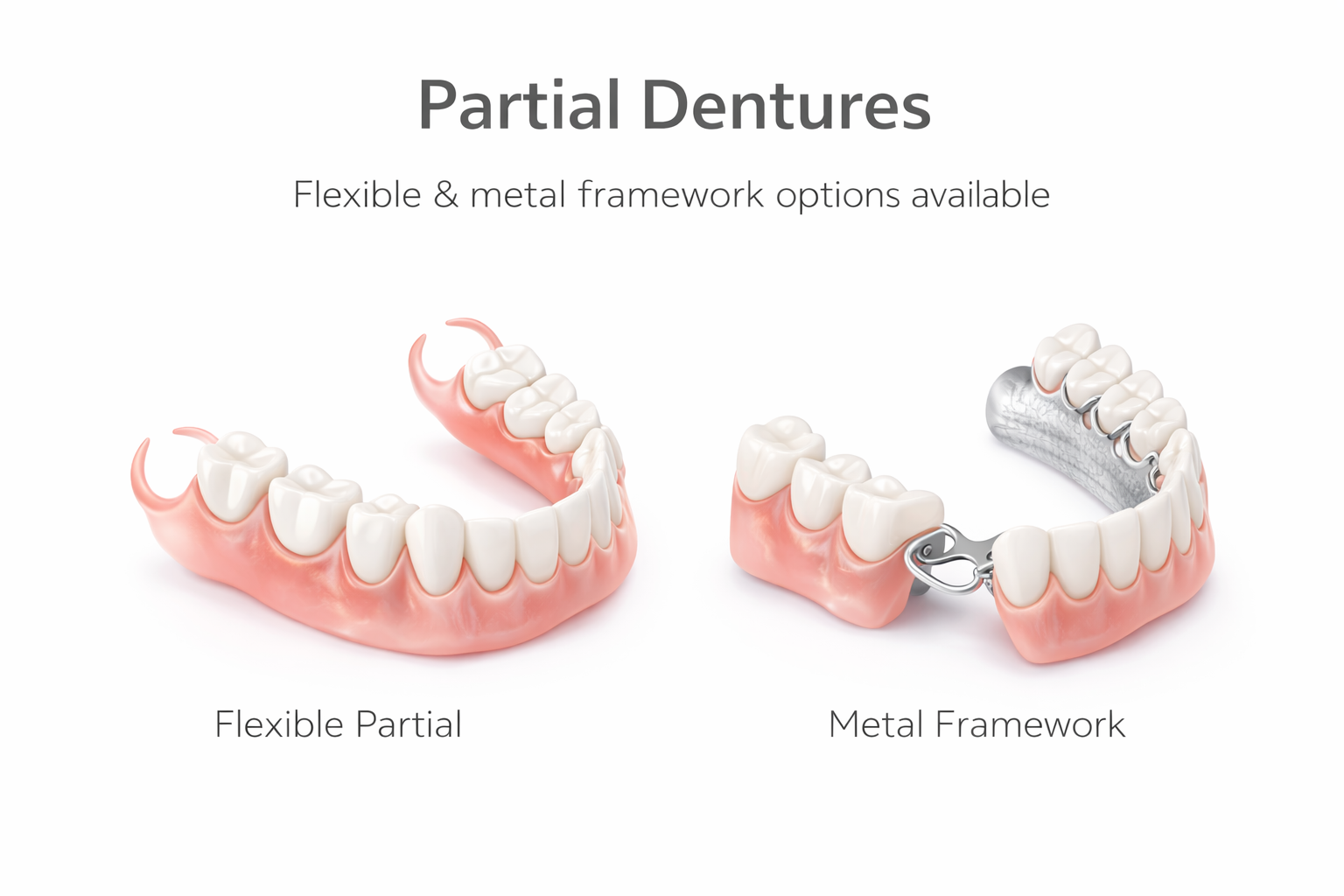 Partial Dentures